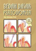 Bedah Dasar Periodonsia